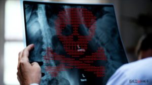 Преступники могут подделать результаты медицинского сканирования с помощью удаленных сетевых атак